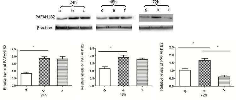 https://cdn.ncbi.nlm.nih.gov/pmc/blobs/85dd/4880285/b67896ddae93/pone.0156017.g005.jpg