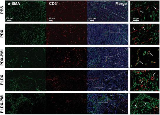 https://cdn.ncbi.nlm.nih.gov/pmc/blobs/85e2/10401096/ee30689e2b27/ADVS-10-2300637-g001.jpg