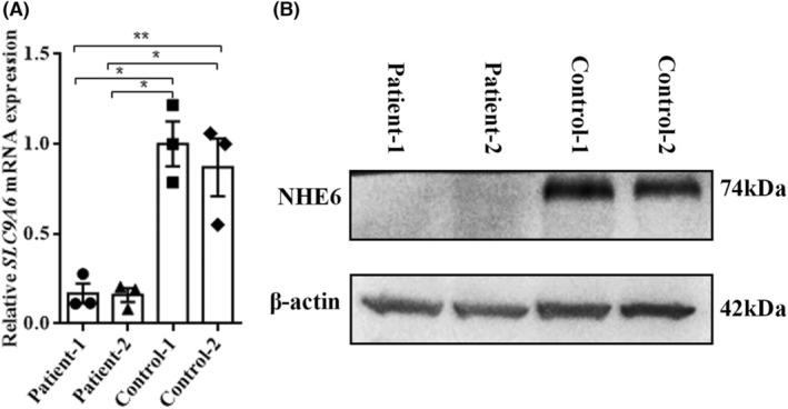 https://cdn.ncbi.nlm.nih.gov/pmc/blobs/85e7/10651982/19210fac54c9/CNS-29-4059-g005.jpg