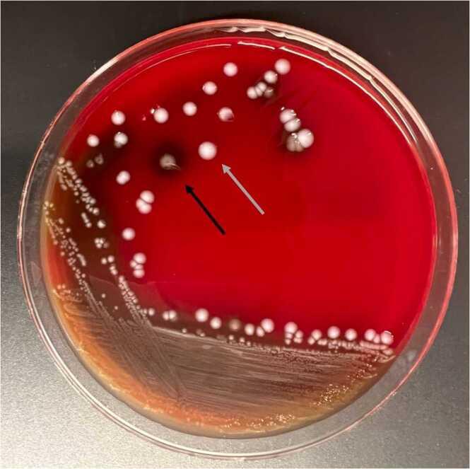 https://cdn.ncbi.nlm.nih.gov/pmc/blobs/85f1/11176958/428c3e74abf4/gr2.jpg
