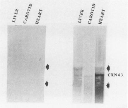 https://cdn.ncbi.nlm.nih.gov/pmc/blobs/85f3/1886737/15863427221d/amjpathol00074-0245-b.jpg