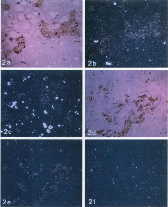 https://cdn.ncbi.nlm.nih.gov/pmc/blobs/85f3/1886737/bb9fc866da15/amjpathol00074-0244-a.jpg