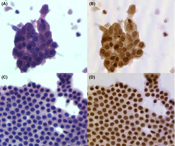 https://cdn.ncbi.nlm.nih.gov/pmc/blobs/85f4/10501295/d0a2ecefbdba/CAM4-12-17005-g006.jpg