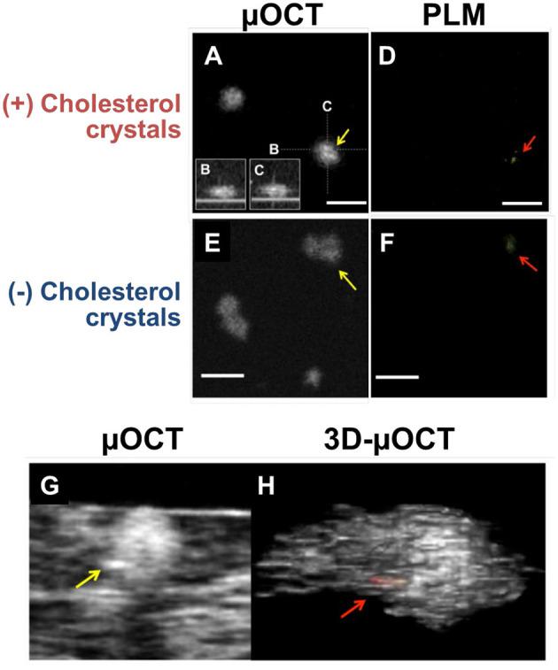 https://cdn.ncbi.nlm.nih.gov/pmc/blobs/85fd/8032864/22fa6e39578b/fcvm-08-613400-g0004.jpg