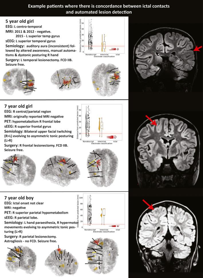 https://cdn.ncbi.nlm.nih.gov/pmc/blobs/85fe/8432161/576098cc4a46/EPI-61-1406-g001.jpg