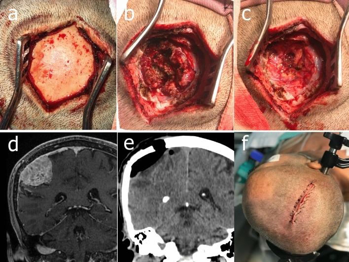 https://cdn.ncbi.nlm.nih.gov/pmc/blobs/8603/7991647/41025a8e0a92/41598_2021_85472_Fig6_HTML.jpg