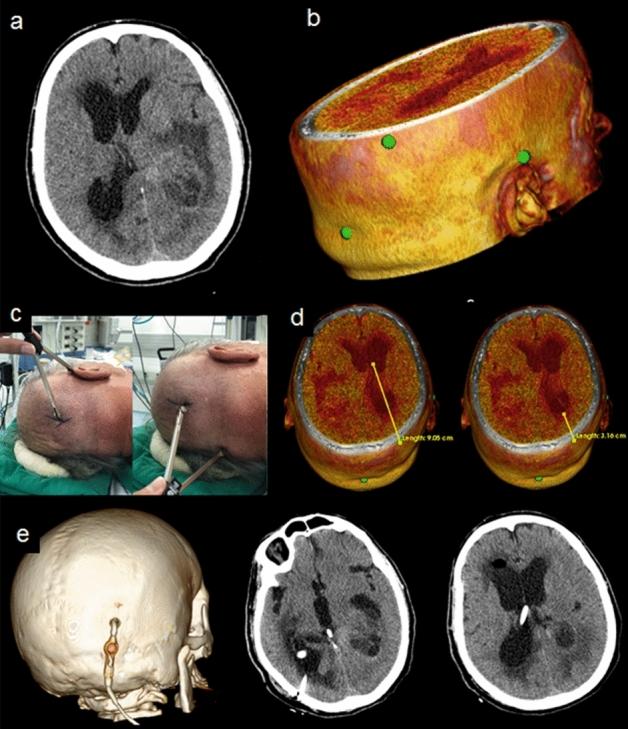 https://cdn.ncbi.nlm.nih.gov/pmc/blobs/8603/7991647/8f7d92f3a6ae/41598_2021_85472_Fig5_HTML.jpg