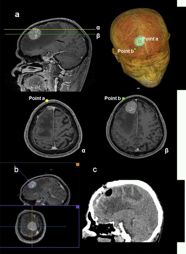 https://cdn.ncbi.nlm.nih.gov/pmc/blobs/8603/7991647/b1cd964f9dd0/41598_2021_85472_Fig7_HTML.jpg