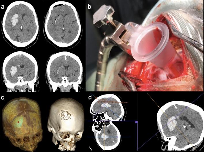 https://cdn.ncbi.nlm.nih.gov/pmc/blobs/8603/7991647/b5a6247a5137/41598_2021_85472_Fig8_HTML.jpg