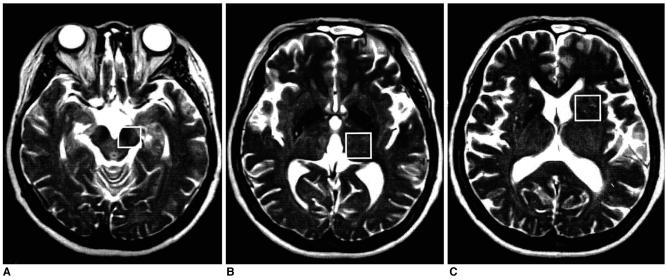 https://cdn.ncbi.nlm.nih.gov/pmc/blobs/8606/2713882/74672855c8f6/kjr-3-180-g001.jpg