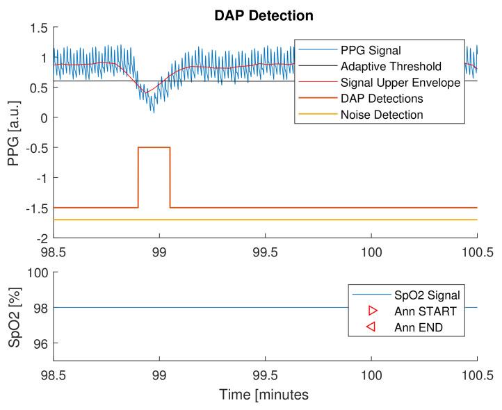https://cdn.ncbi.nlm.nih.gov/pmc/blobs/860e/8659764/36aa14d56536/sensors-21-07976-g007.jpg