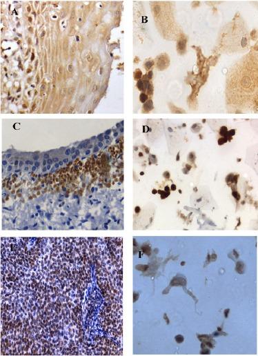 https://cdn.ncbi.nlm.nih.gov/pmc/blobs/8611/5844608/fd9c9cbeddf3/APJCP-19-141-g002.jpg