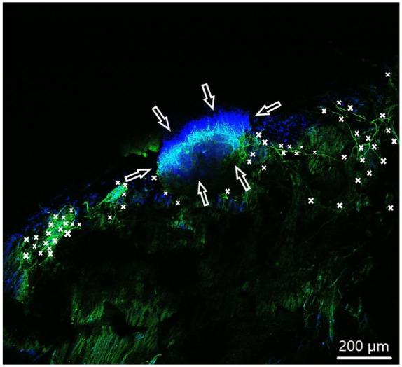 https://cdn.ncbi.nlm.nih.gov/pmc/blobs/8618/7221869/291d8e5d131d/10.1177_0391398819868481-fig5.jpg