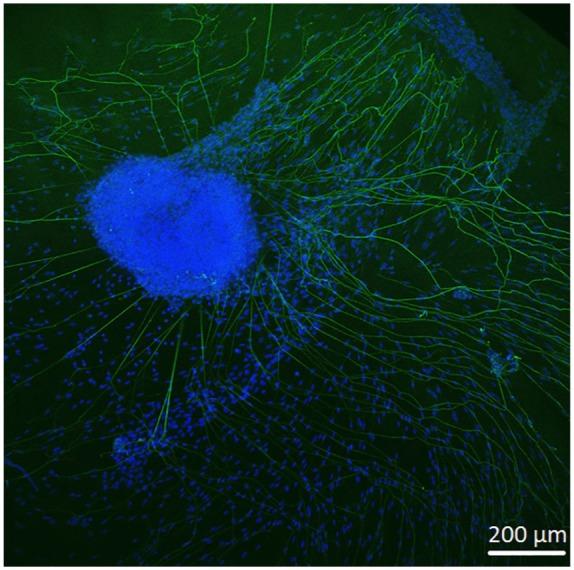 https://cdn.ncbi.nlm.nih.gov/pmc/blobs/8618/7221869/5a50c8f638aa/10.1177_0391398819868481-fig7.jpg