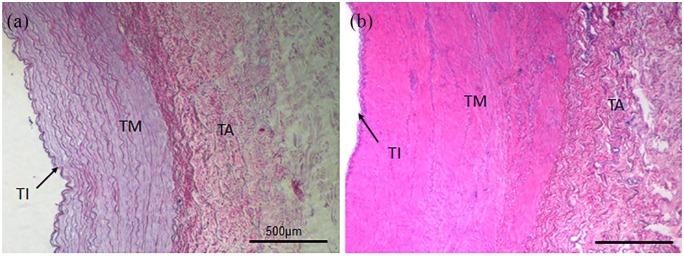 https://cdn.ncbi.nlm.nih.gov/pmc/blobs/8618/7221869/9d188707a28d/10.1177_0391398819868481-fig1.jpg