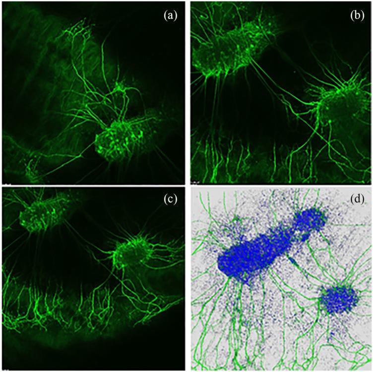 https://cdn.ncbi.nlm.nih.gov/pmc/blobs/8618/7221869/bf623a3ff9c0/10.1177_0391398819868481-fig3.jpg