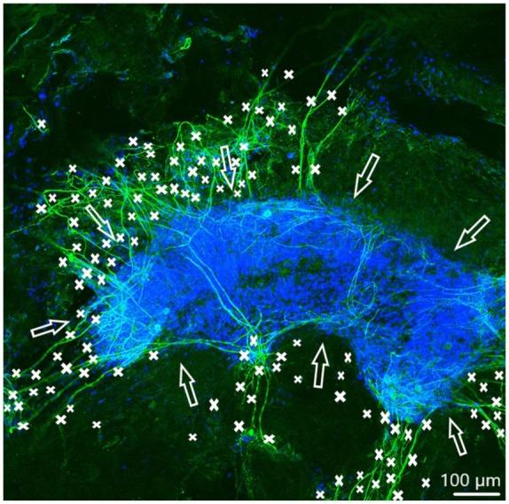 https://cdn.ncbi.nlm.nih.gov/pmc/blobs/8618/7221869/f6f4aa3b8332/10.1177_0391398819868481-fig4.jpg