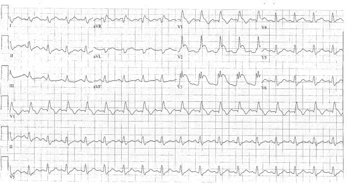 https://cdn.ncbi.nlm.nih.gov/pmc/blobs/8619/5358171/4885a2535092/cr-05-108-g001.jpg