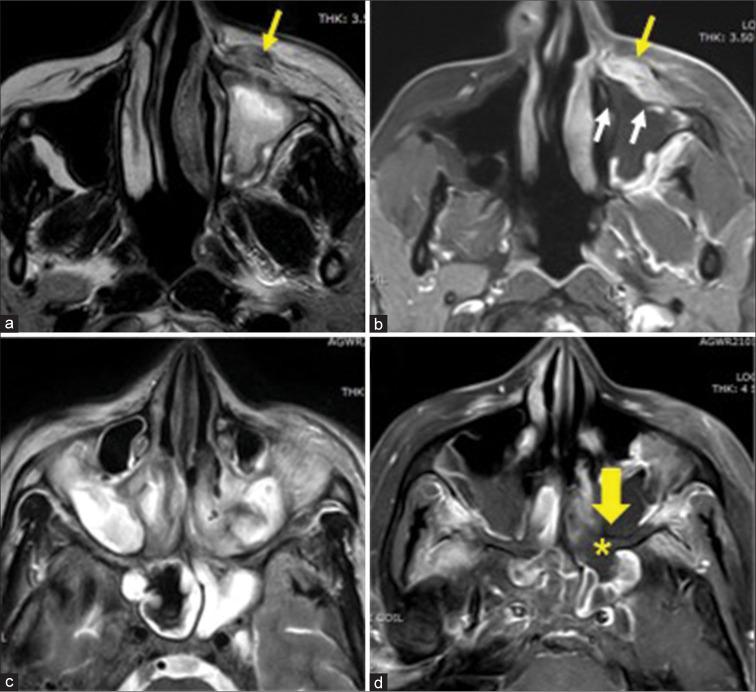 https://cdn.ncbi.nlm.nih.gov/pmc/blobs/8623/10481822/5f9eab61c1ec/JCIS-13-23-g003.jpg