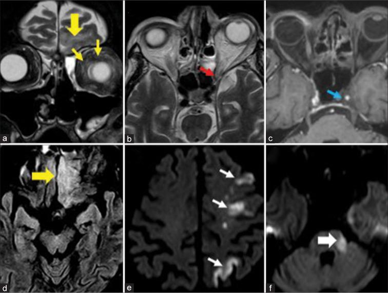 https://cdn.ncbi.nlm.nih.gov/pmc/blobs/8623/10481822/9b3417c78b98/JCIS-13-23-g006.jpg