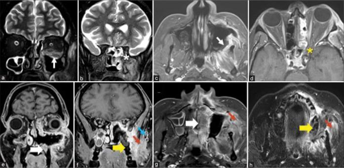 https://cdn.ncbi.nlm.nih.gov/pmc/blobs/8623/10481822/d0bf729bad26/JCIS-13-23-g007.jpg