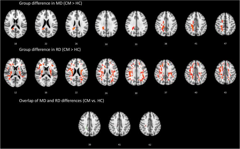 https://cdn.ncbi.nlm.nih.gov/pmc/blobs/8625/7368770/4801439de773/10194_2020_1159_Fig1_HTML.jpg