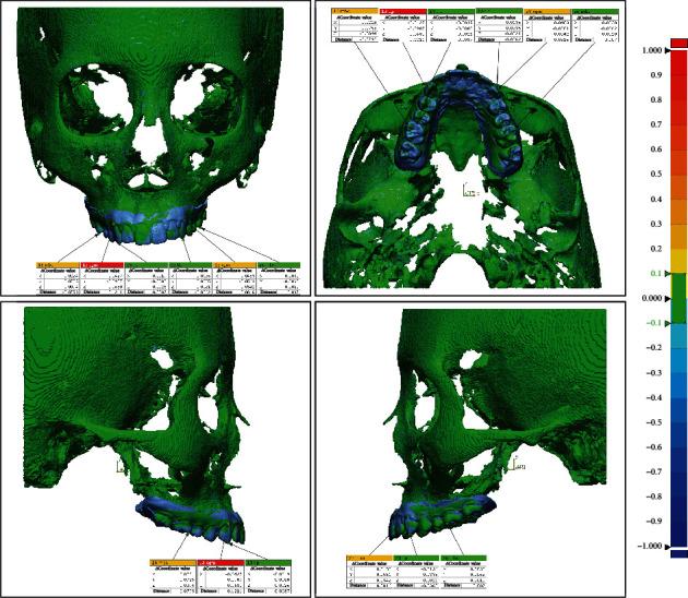 https://cdn.ncbi.nlm.nih.gov/pmc/blobs/862b/8913058/c050cb735903/SCANNING2022-8221514.002.jpg