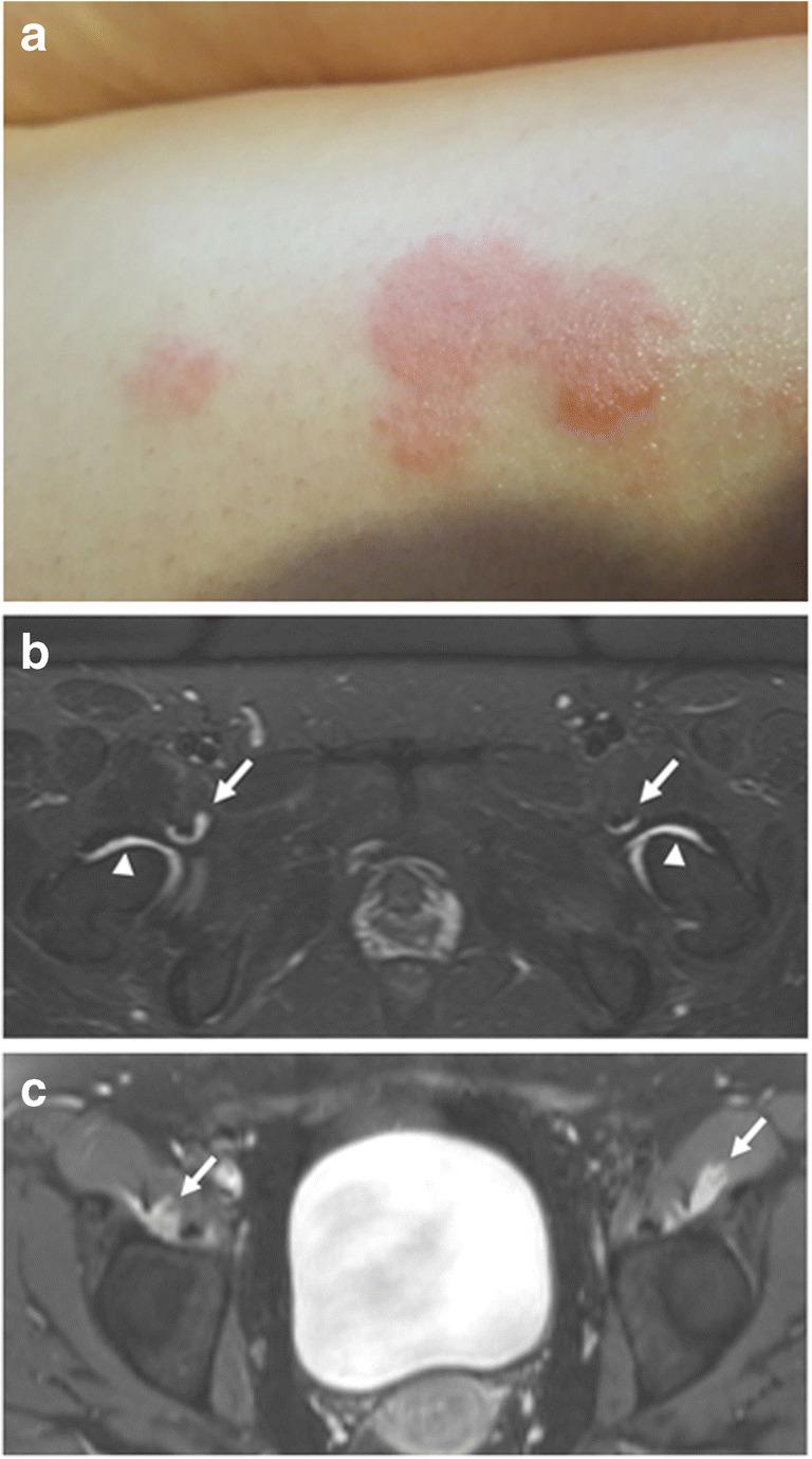 https://cdn.ncbi.nlm.nih.gov/pmc/blobs/8634/7889306/273dbf22885a/256_2021_3734_Fig7_HTML.jpg