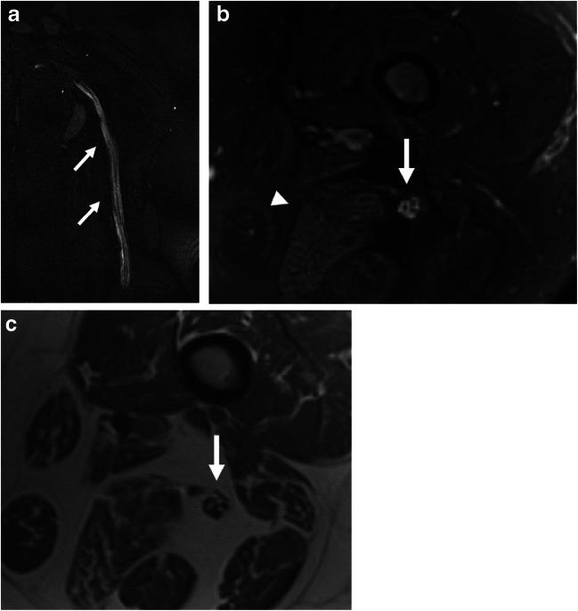 https://cdn.ncbi.nlm.nih.gov/pmc/blobs/8634/7889306/3882fd24c2f3/256_2021_3734_Fig5_HTML.jpg