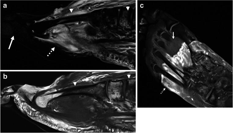 https://cdn.ncbi.nlm.nih.gov/pmc/blobs/8634/7889306/70de5df6704b/256_2021_3734_Fig8_HTML.jpg