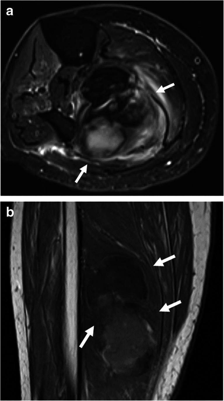 https://cdn.ncbi.nlm.nih.gov/pmc/blobs/8634/7889306/83224926635f/256_2021_3734_Fig9_HTML.jpg