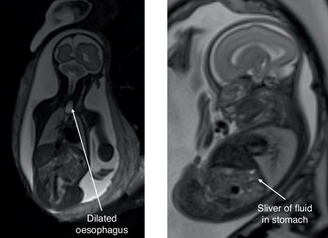 https://cdn.ncbi.nlm.nih.gov/pmc/blobs/8636/12122378/9a3f673074d7/41390_2024_3503_Fig2_HTML.jpg