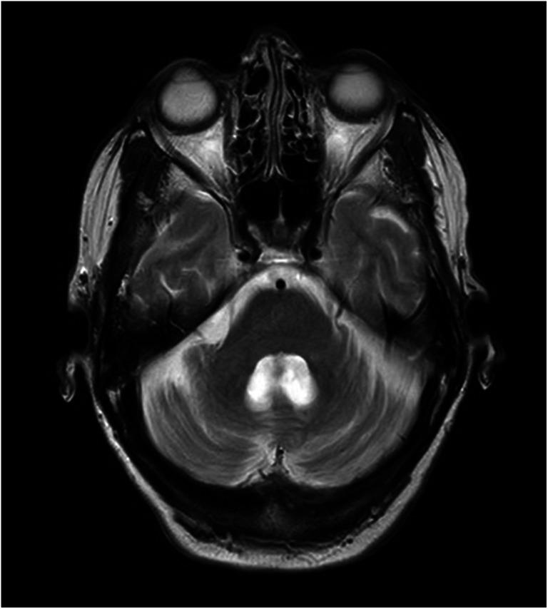 https://cdn.ncbi.nlm.nih.gov/pmc/blobs/8645/8004502/e762491a6409/12311_2020_1203_Fig2_HTML.jpg