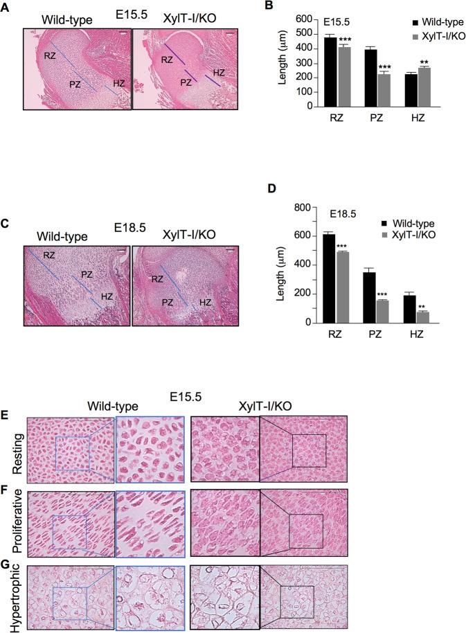 https://cdn.ncbi.nlm.nih.gov/pmc/blobs/8649/10256685/adbd1b518ed3/41419_2023_5875_Fig2_HTML.jpg