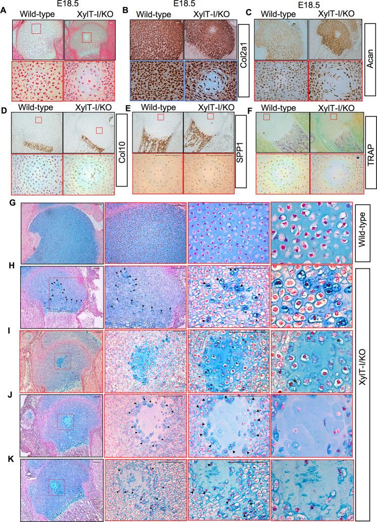https://cdn.ncbi.nlm.nih.gov/pmc/blobs/8649/10256685/e9d198b41bd6/41419_2023_5875_Fig4_HTML.jpg