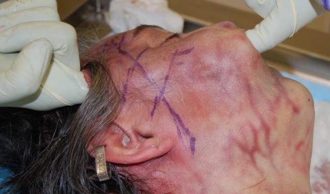 https://cdn.ncbi.nlm.nih.gov/pmc/blobs/864b/3146706/b462827f5b83/266_2011_9665_Fig2_HTML.jpg