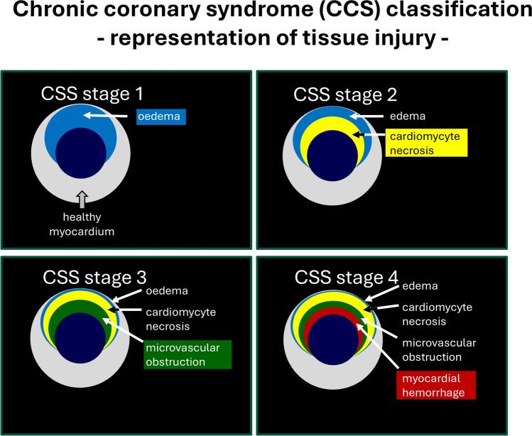 https://cdn.ncbi.nlm.nih.gov/pmc/blobs/8653/11976342/52db37a43792/395_2024_1094_Fig3_HTML.jpg