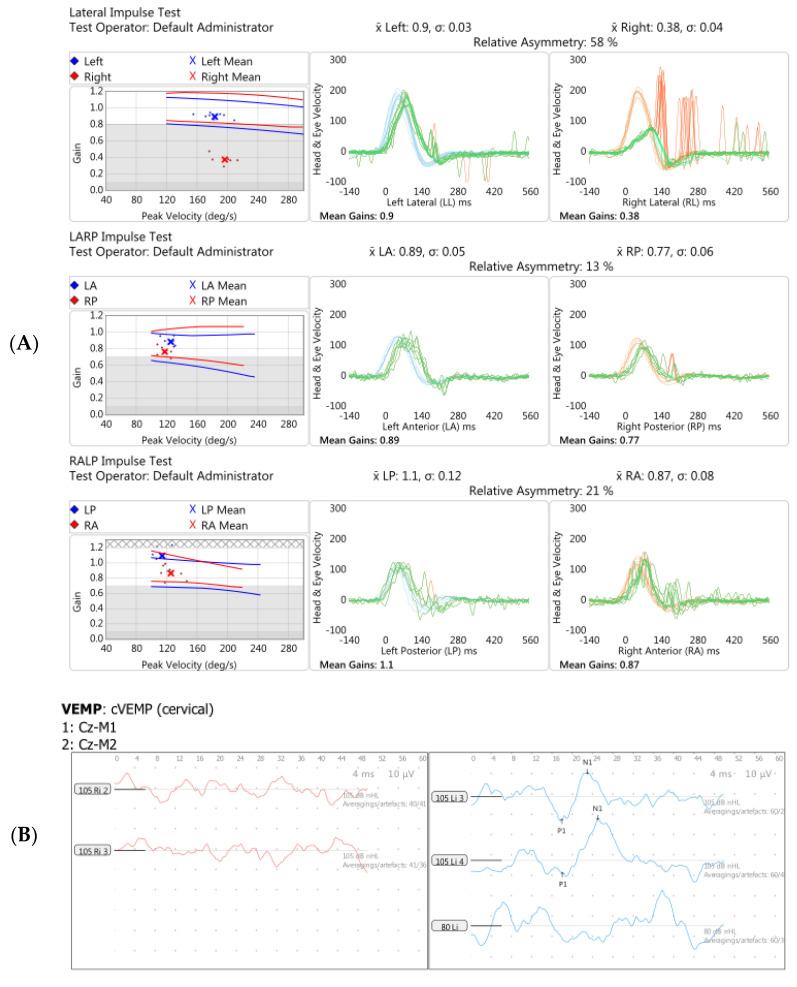 https://cdn.ncbi.nlm.nih.gov/pmc/blobs/8655/8946225/681c3db63598/brainsci-12-00306-g005a.jpg
