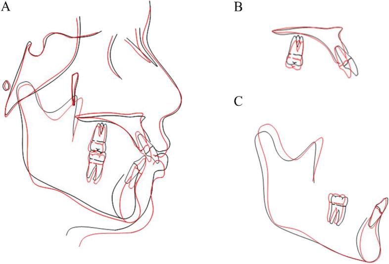 https://cdn.ncbi.nlm.nih.gov/pmc/blobs/865a/11479465/d1b826cac23b/12903_2024_4902_Fig8_HTML.jpg