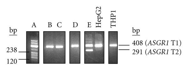 https://cdn.ncbi.nlm.nih.gov/pmc/blobs/865b/3419429/997b5ec463b6/MBI2012-283974.003.jpg