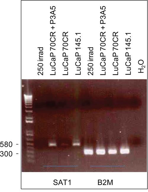 https://cdn.ncbi.nlm.nih.gov/pmc/blobs/865e/5226518/601917c42305/oncotarget-07-49425-g006.jpg