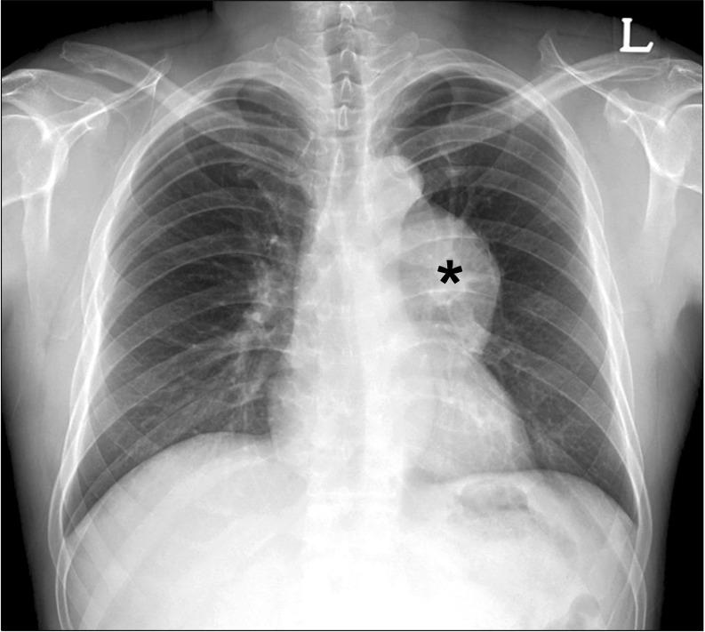 https://cdn.ncbi.nlm.nih.gov/pmc/blobs/865f/3756166/78f3836e98a1/kjtcs-46-305-g001.jpg