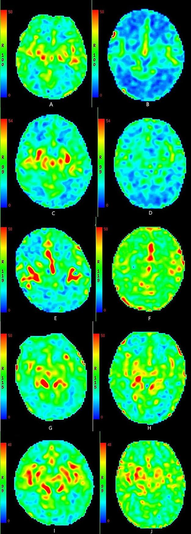 https://cdn.ncbi.nlm.nih.gov/pmc/blobs/8664/6613698/ff4b34f8b40e/pone.0219284.g004.jpg