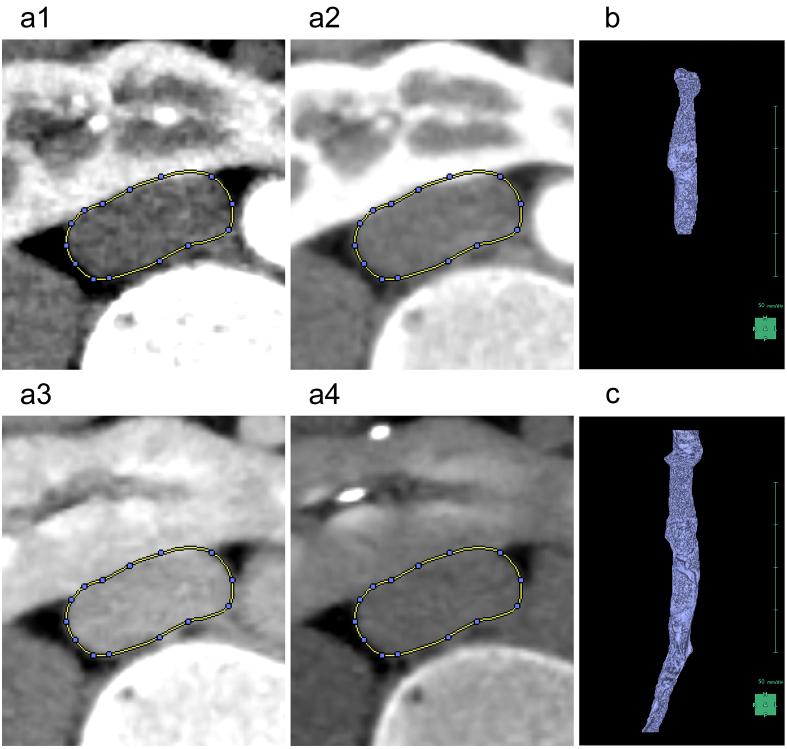 https://cdn.ncbi.nlm.nih.gov/pmc/blobs/8666/11543326/9b5f0e98e88a/2433-3298-7-4-0471-g006.jpg