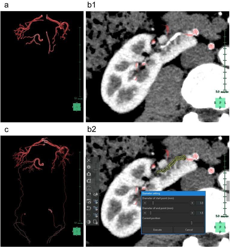 https://cdn.ncbi.nlm.nih.gov/pmc/blobs/8666/11543326/fc6eb6175f8e/2433-3298-7-4-0471-g004.jpg