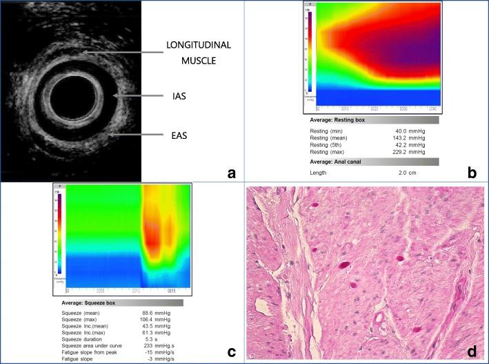 https://cdn.ncbi.nlm.nih.gov/pmc/blobs/866a/6199719/f6bba17a3209/13256_2018_1856_Fig1_HTML.jpg