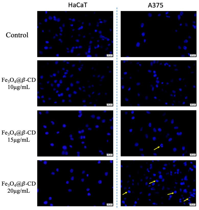 https://cdn.ncbi.nlm.nih.gov/pmc/blobs/866c/12348813/1c9fde51a90c/nanomaterials-15-01192-g004.jpg