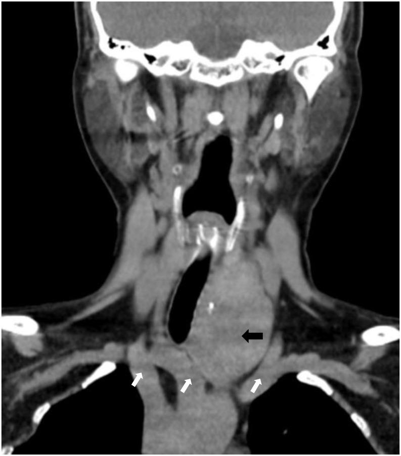 https://cdn.ncbi.nlm.nih.gov/pmc/blobs/866f/12381769/00a75d9bfeae/fonc-15-1651824-g001.jpg