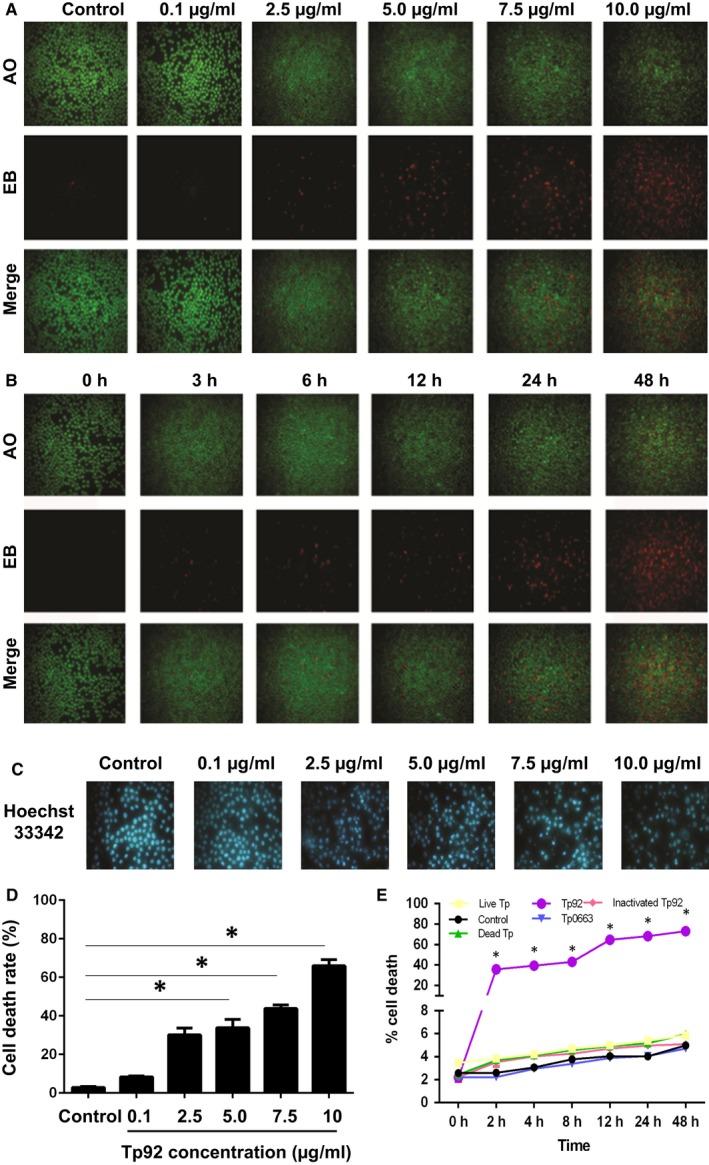 https://cdn.ncbi.nlm.nih.gov/pmc/blobs/866f/6237608/0cc08156592f/JCMM-22-6039-g001.jpg