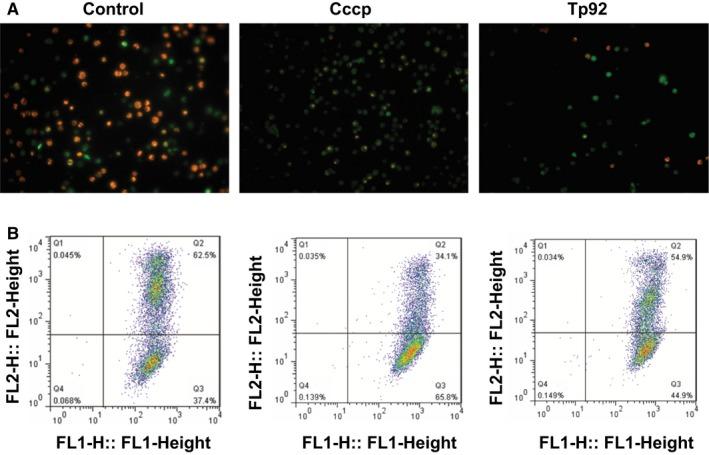 https://cdn.ncbi.nlm.nih.gov/pmc/blobs/866f/6237608/98c0b8e29f81/JCMM-22-6039-g004.jpg